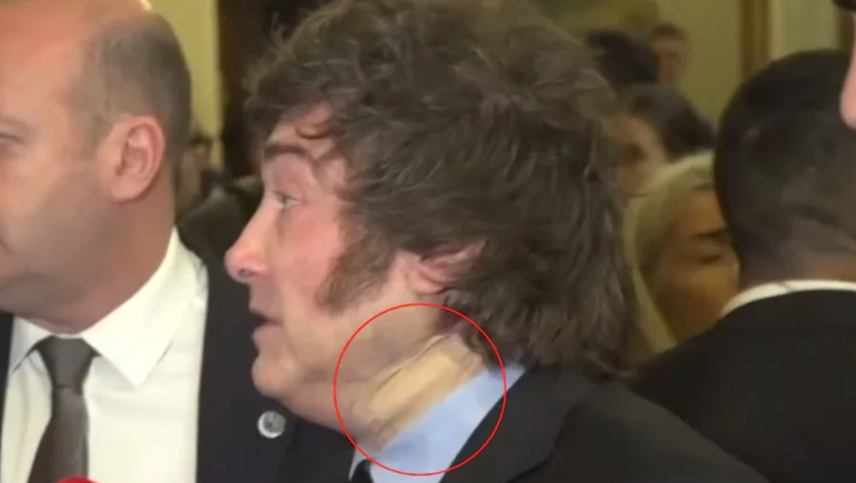 El misterio de la venda en el cuello: por qué apareció lesionado Javier Milei
