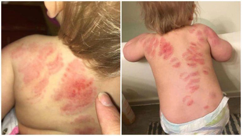 Mordieron 25 veces a una beba en una guardería