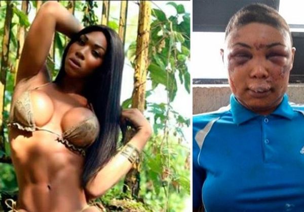 La Policía de Brasil desfiguró a golpes a una porno star trans