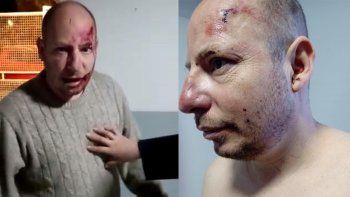 acusan a dos policias de un violento desalojo en el dvn acusan a dos policias de un violento desalojo en el dvn