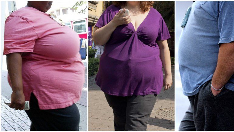 Las proyecciones de obesidad preocupan a nivel global.