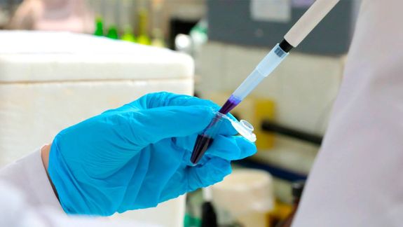 Los investigadores de la UBA desarrollaron un test sanguíneo