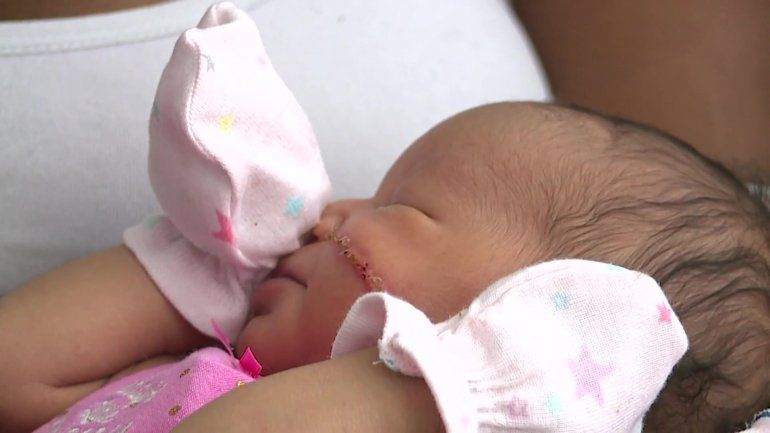 Kyanni Williams: la beba a la que le cortaron la cara en la cesárea de su nacimiento