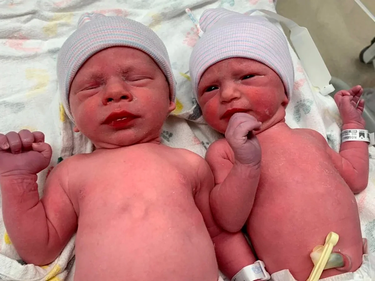 Récord: nacieron gemelos de embriones congelados hace 30 años