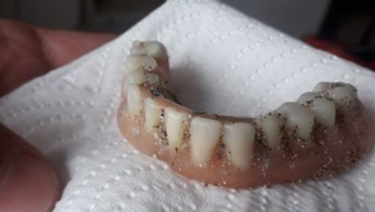Halló una dentadura en la playa y movilizó las redes para hallar al dueño
