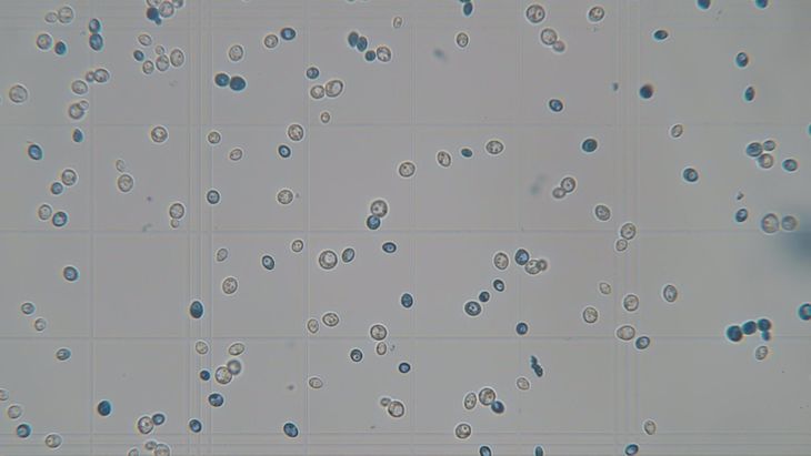 Los hongos son capaces de transformar materias primas en productos finales como pan, cerveza, vino, quesos, chocolate, sake, whisky, miso, kimchi, kéfir, kombucha, entre otros. Foto: gentileza. Los hongos son capaces de transformar materias primas en productos finales como pan, cerveza, vino, quesos, chocolate, sake, whisky, miso, kimchi, kéfir, kombucha, entre otros. Foto: gentileza.