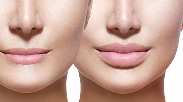 Test de personalidad: ¿qué tipo de labios tenés y qué dicen de tu forma de ser?