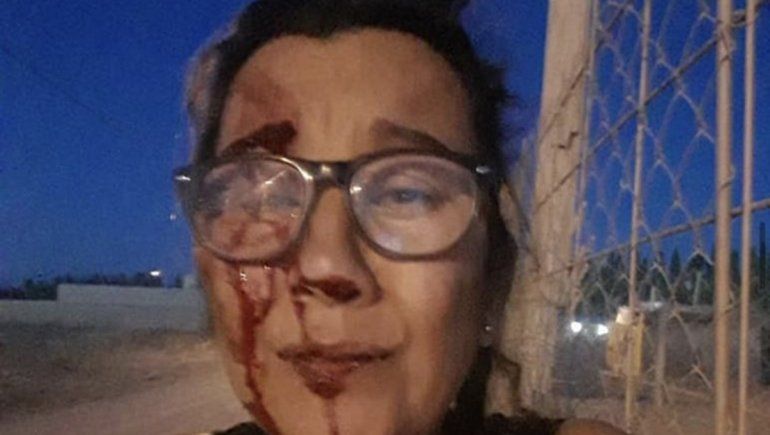 Creí que me mataba, contó una sobreviviente