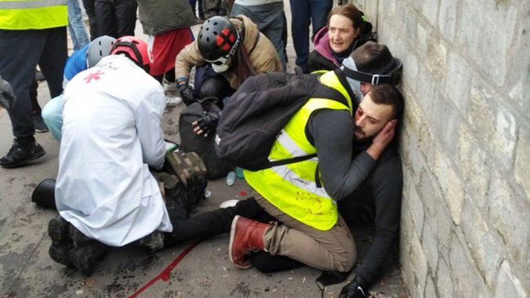 Francia: un hombre perdió una mano en una protesta