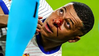 Mbappé con la cara llena de sangre después del golpe involuntario que sufrió. Mbappé con la cara llena de sangre después del golpe involuntario que sufrió.