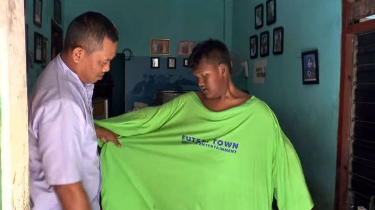 El nene más obeso del mundo bajó 100 kilos y va por más