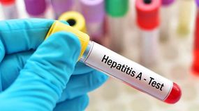 Argentina está en alerta por hepatitis A. | LM Neuquen Argentina está en alerta por hepatitis A.