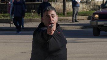 agresor disparo incidentes san martin de los andes -PLANO MAS CERCA-