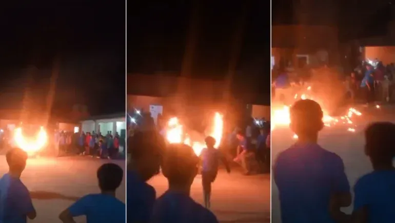 Un alumno terminó con quemaduras al usar aros con fuego en una escuela