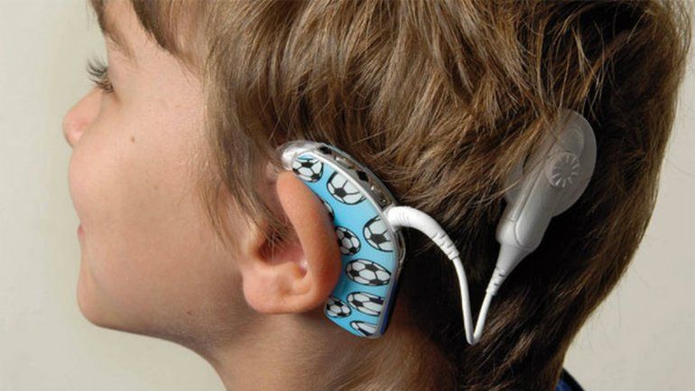 Se perdió un aparato que ayuda a escuchar a un niño hipoacúsico