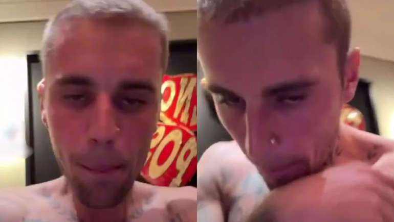Justin Bieber hizo extrañas apariciones en redes sociales que despertaron preocupación con su salud.