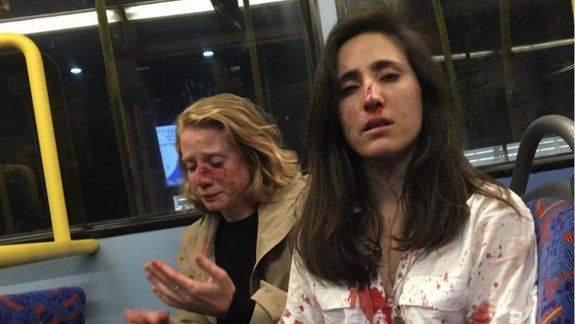 Brutal golpiza en un micro a una azafata uruguaya y a su novia en Londres