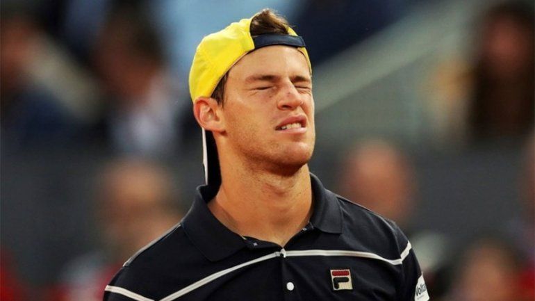 El argentino cayó en tres sets.