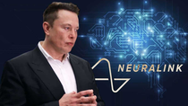 elon musk ya instalo su chip en el cerebro de un humano elon musk ya instalo su chip en el cerebro de un humano