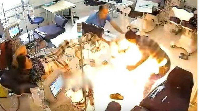 Quemó vivo a otro paciente en un hospital albanés