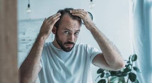 Covid-19: ¿Los calvos tienen mayor riesgo de sufrir complicaciones?