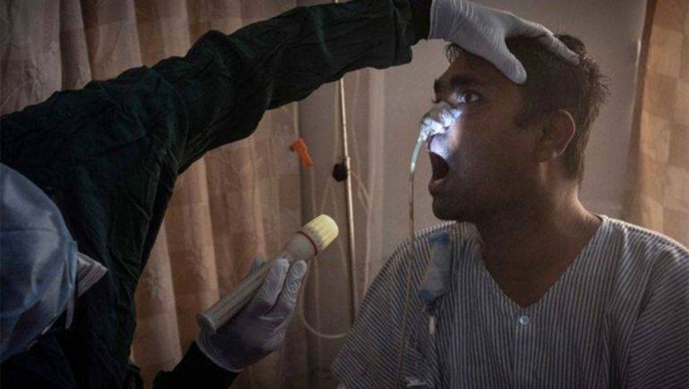 El hongo negro, la rara infección que ataca a pacientes COVID, llegó a Uruguay