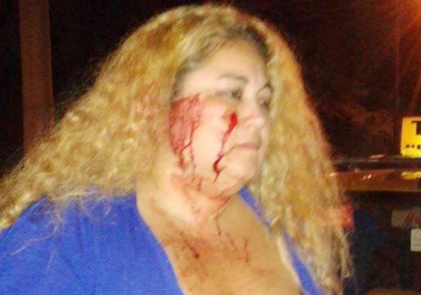 Confluencia: tajearon  en la cara a una taxista