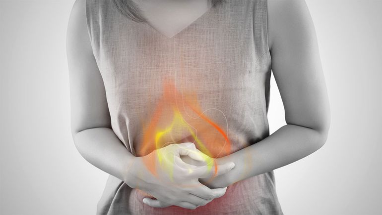Acidez estomacal, enfermedad por reflujo gastroesofágico y gastritis: ¿En qué se diferencian?