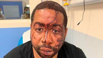 francia: policias le dieron una paliza a un hombre negro francia: policias le dieron una paliza a un hombre negro