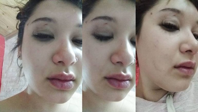 Cipo: rescataron a una joven golpeada que tenían encerrada