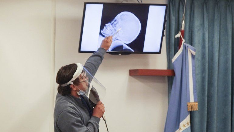 María Marta no se defendió y pudo haber sido estrangulada