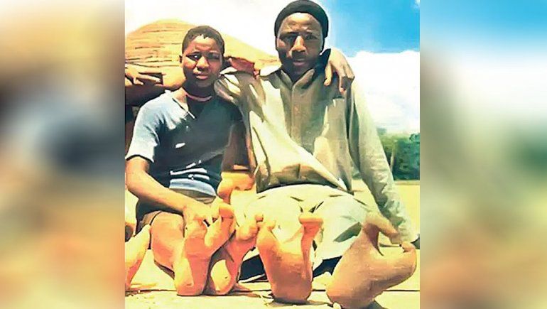 El extraño caso de una tribu con pies de avestruz