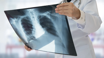 tuberculosis.jpg