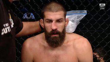 condit se reencontro con el triunfo y le destrozo la nariz a su rival condit se reencontro con el triunfo y le destrozo la nariz a su rival