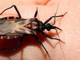 Un medicamento contra el cáncer podría ser clave para tratar el Chagas crónico