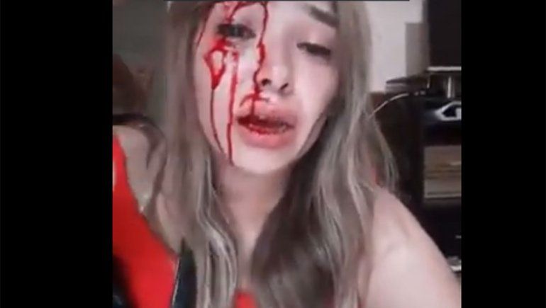 Con el rostro lleno de sangre, denunció el salvaje ataque de su pareja en las redes