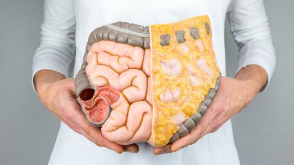 Algunos especialistas atribuyen la enfermedad al alto consumo de asado y carnes ahumadas, además de la baja ingesta de frutas y verduras.&nbsp;