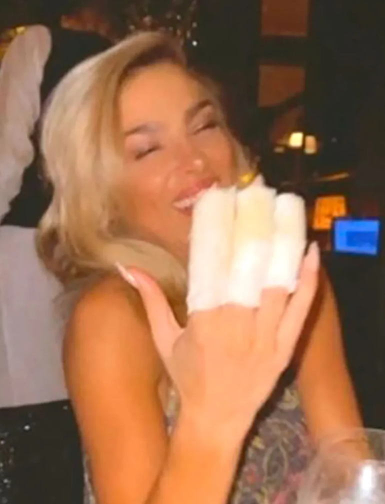 Ailén se quemó con la bucleadora y tuvo que vendarse los dedos.