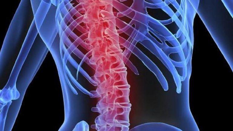 Hoy es el Día Mundial de la Osteoporosis