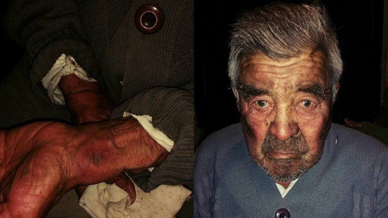 Golpearon a un abuelo y lo dejaron atado más de 12 horas para robarle