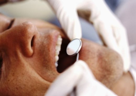 El sarro de los dientes aparece en todas las personas. El sarro de los dientes aparece en todas las personas.