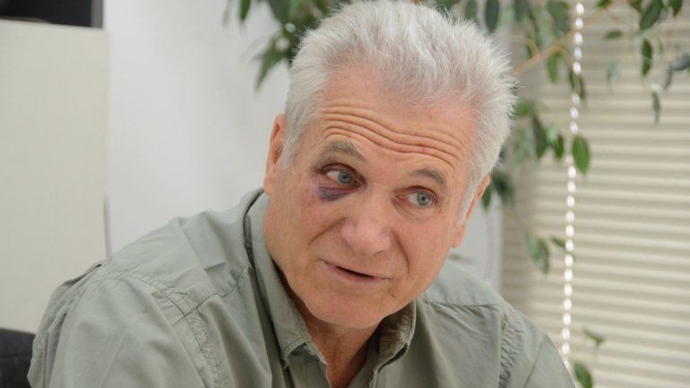 Juan Carlos muestra su ojo golpeado por los delincuentes que irrumpieron en su comercio