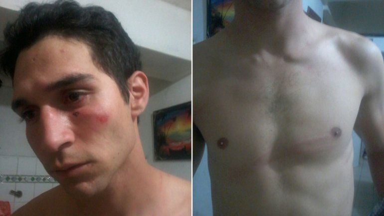 Versiones cruzadas tras la denuncia por apremios en barrio Don Bosco