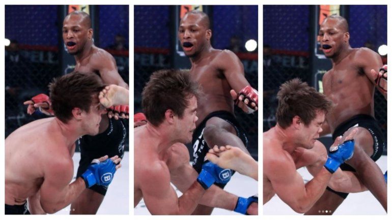 Con impactante patada, destrozó la nariz y le desfiguró la cara a su rival