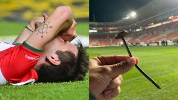 tremenda lesion y lagrimas de dolor de futbolista en mexico tremenda lesion y lagrimas de dolor de futbolista en mexico