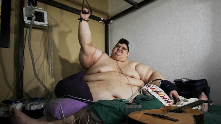 Juan Pedro vive en Aguascalientes y es de una familia de pocos recursos. Un equipo médico lo atiende gratis.