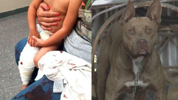 Pitbull atacó una nena.&nbsp;