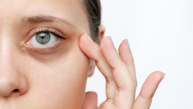 Adiós a las ojeras: el truco sencillo y efectivo con manzanilla para eliminarlas