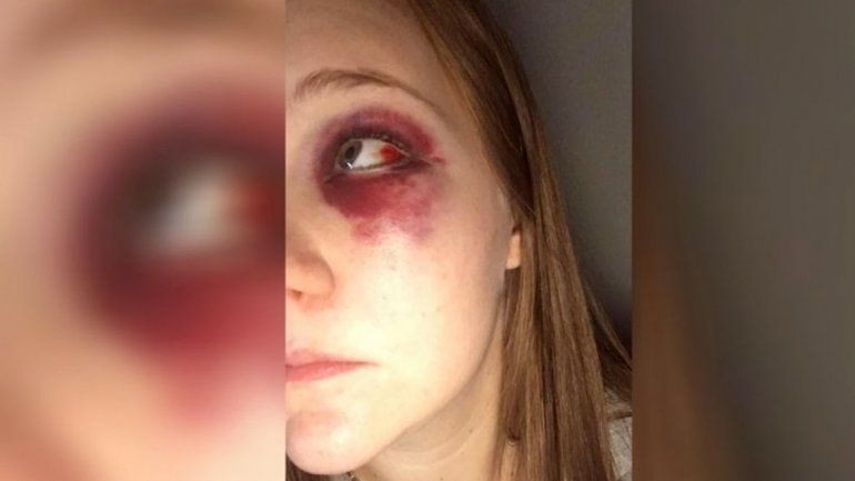 Constanza radicó la denuncia policial y mostró por Face cómo quedó.