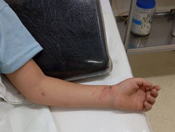 El nene debió ser internado.&nbsp;